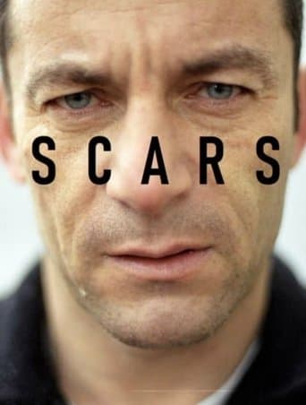 Scars Image