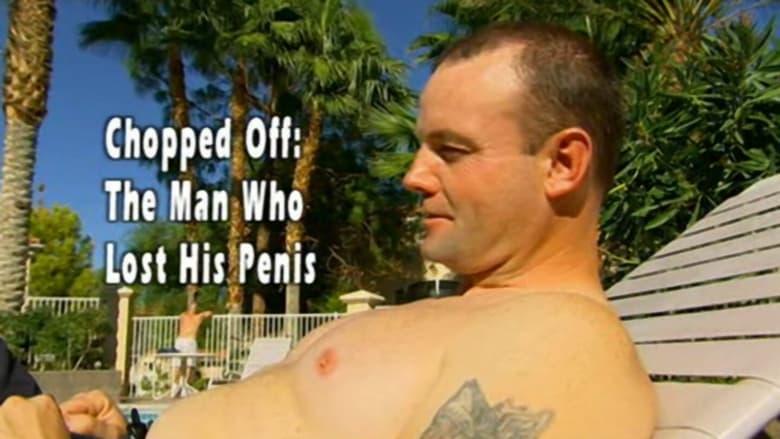 Chopped Off: The Man Who Lost His Penis image